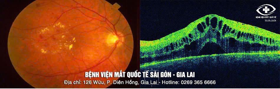 518381175_1324211779709143_5940401261659747071_n