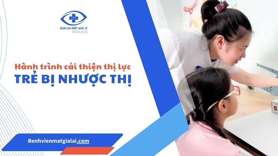 dieu-tri-nhuoc-thi-cho-tre