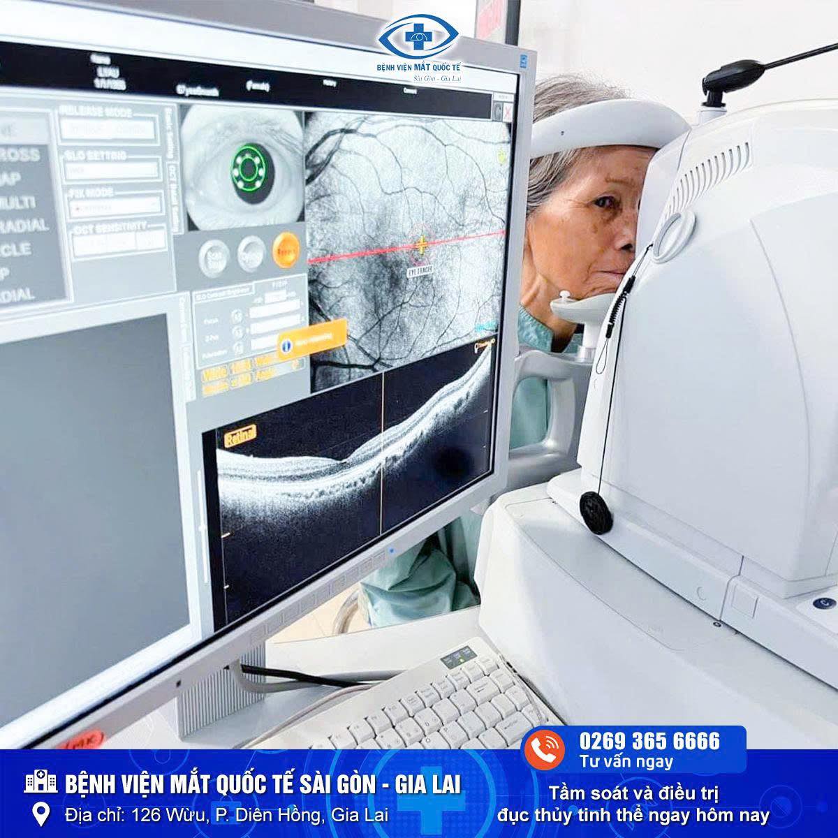 quang dong vong mach gia lai 1