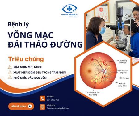 Bệnh võng mạc đái tháo đường là gì? Phương pháp điều trị.